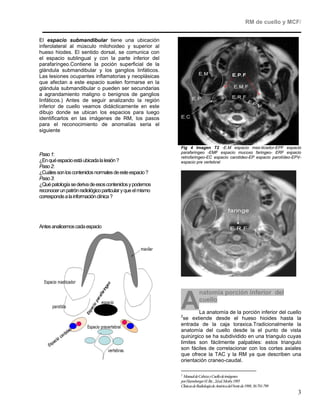 RM de cuello y MCF/


El espacio submandibular tiene una ubicación
inferolateral al músculo milohoideo y superior al
hueso hiodes. El sentido dorsal, se comunica con
el espacio sublingual y con la parte inferior del
parafaríngeo.Contiene la poción superficial de la
glándula submandibular y los ganglios linfáticos.
Las lesiones ocupantes inflamatorias y neoplásicas
que afectan a este espacio suelen formarse en la
glándula submandibular o pueden ser secundarias
a agrandamiento maligno o benignos de ganglios
linfáticos.) Antes de seguir analizando la región
inferior de cuello veamos didácticamente en este
dibujo donde se ubican los espacios para luego
identificarlos en las imágenes de RM, los pasos
para el reconocimiento de anomalías seria el
siguiente


                                                            Fig 4 Imagen T2 -E.M espacio mas-ticador-EPF espacio
                                                            parafaringeo -EMF espacio mucoso faringeo- ERF espacio
Paso 1:                                                     retrofaringeo-EC espacio carotideo-EP espacio parotídeo-EPV-
¿En qué espacio está ubicada la lesión ?                    espacio pre vertebral
Paso 2:
¿Cuáles son los contenidos normales de este espacio ?
Paso 3:
¿Qué patología se deriva de esos contenidos y podemos
reconocer un patrón radiológico particular y que el mismo
corresponde a la información clínica ?




Antes analicemos cada espacio




                                                                         natomia porción inferior del

                                                            A
                                                            2
                                                                         cuello
                                                                    La anatomía de la porción inferior del cuello
                                                              se extiende desde el hueso hioides hasta la
                                                            entrada de la caja toraxica.Tradicionalmente la
                                                            anatomía del cuello desde la el punto de vista
                                                            quirúrgico se ha subdividido en una triangulo cuyas
                                                            limites son fácilmente palpables: estos triangulo
                                                            son fáciles de correlacionar con los cortes axiales
                                                            que ofrece la TAC y la RM ya que describen una
                                                            orientación craneo-caudal.

                                                            2
                                                              Manual de Cabeza y Cuello de imágenes
                                                            por Harnsberger H. Ric , 2d ed. Mosby 1995
                                                            Clínicas de Radiología de América del Norte de 1998; 36:781-799
                                                                                                                              3
 