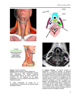 RM de cuello y MCF/




Anterior: visceral y carotídeo                       El espacio visceral           es central contiene la
Posterior: plexo braquial y cadena ganglio-nar       hipolaringe y traquea,el esofago ,la glándula
Como ocurre en la región suprahiodea también         tiroides, las paratiroides remanentes embriologicos
están     delimitados     por   fascias   formando   como quistes del conducto tirogloso, linfáticos para-
compartimentos algunos de estos espacios se          traqueales y el nervio recurrente laríngeo.La laringe
continúan con los espacios de la región              se divide en tres sectores:1-la supraglotis que se
suprahiodea y a su vez están en continuidad con el   extiende desde la punta de la epiglotis hasta los
mediastino superior.                                 ventrículos laringeos y contiene la epiglotis,l os
                                                     pliegues aritenoepigloticos, los cartílagos arite-
El    cuello infrahioides se divide        en   5    noides y las cuerdas vocales falsas; 2-la glotis que
compartimentos o espacios por las distintas capas    se compone de las cuerdas vocales verdaderas y
de la fascia cervical                                3- la subglotis que abarca desde la superficie
                                                     inferior de las cuerdas vocales verdaderas hasta la
                                                     superficie inferior del cartilago cricoides.

                                                                                                        4
 