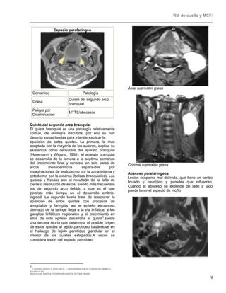 RM de cuello y MCF/


                         Espacio parafaríngeo




                                                                                             Axial supresión grasa
    Contenido                                            Patología
                                          Quiste del segundo arco
    Grasa
                                          branquial
    Peligro por
                                          MTTS/abscesos
    Diseminacion

Quiste del segundo arco branquial
El quiste branquial es una patología relativamente
común, de etiología discutida; por ello se han
descrito varias teorías para intentar explicar la
aparición de estos quistes. La primera, la más
aceptada por la mayoría de los autores, explica su
existencia como derivados del aparato branquial
(Hosemann y Wigand, 1988); el aparato branquial
se desarrolla de la tercera a la séptima semanas
del crecimiento fetal y consiste en seis pares de
                                                                                             Coronal supresión grasa
arcos       mesodérmicos         separa-dos        por
invaginaciones de endodermo por la zona interna y
                                                                                             Absceso parafaringeos
ectodermo por la externa (bolsas branquiales). Los
                                                                                             Lesión ocupante mal definida, que tiene un centro
quistes y fístulas son el resultado de la falta de                                           licuado y neurótico y paredes que refuerzan.
cierre o resolución de éstos, siendo más frecuentes
                                                                                             Cuando el absceso se extiende de lado a lado
las de segundo arco debido a que es el que                                                   puede tener el aspecto de moño
persiste más tiempo en el desarrollo embrio-
lógico9. La segunda teoría trata de relacionar la
aparición de estos quistes con procesos de
amigdalitis y faringitis; así el epitelio escamoso
derivado de la faringe llega a la vía linfática, a los
ganglios linfáticos regionales y el crecimiento en
ellos de este epitelio desarrolla el quiste3.Existe
una tercera teoría que determina el posible origen
de estos quistes al tejido parotídeo basándose en
el hallazgo de tejido parotídeo glandular en el
interior de los quistes extirpados.A veces se
considera lesión del espacio parotídeo




3
  I. GALLEGO ARANDA, P. GETE GARCÍA, A. I. BALLESTEROS GARCÍA, J. CRESPO DEL HIERRO ,J. J.
ÁLVAREZ VICENT
SERVICIO ORL. HOSPITAL UNIVERSITARIO DOCE DE OCTUBRE. MADRID

                                                                                                                                            9
 