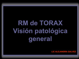 LIC ALEJANDRA GALVEZ RM de TORAX Visión patológica general 