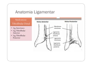 Anatomia Ligamentar
    Sindesmose             Ligamento                            Ligamento
 Tibiofibular Distal     Col...