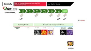 RM en el diagnóstico de toxicidad CV
inmunomediada Ana Martín García
Localizadores
Surwey
T2w (STIR)
Análisis de deformaci...