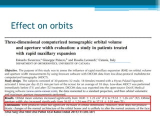 Midpalatal Suture
Image Source: Bhalajhi SI. Orthodontics: At The Art and Science (3rd Ed)
 