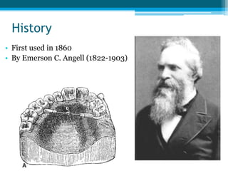 History
• First used in 1860
• By Emerson C. Angell (1822-1903)
 