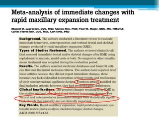 Mid-palatal suture: Mean expansion
Posterior region
= 1.6 -4.33 mm
= 22%–53% screw expansion
Anterior region
 