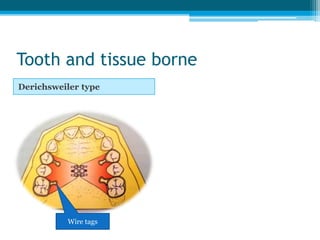 History
• Walter Coffin – 1877
 