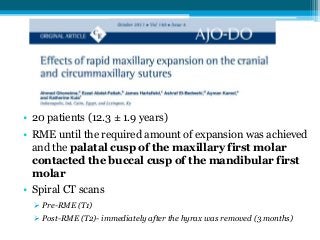 • 20 patients (12.3 ± 1.9 years)
• RME until the required amount of expansion was achieved
and the palatal cusp of the maxillary first molar
contacted the buccal cusp of the mandibular first
molar
• Spiral CT scans
 Pre-RME (T1)
 Post-RME (T2)- immediately after the hyrax was removed (3 months)
 