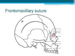 Frontomaxillary suture
 