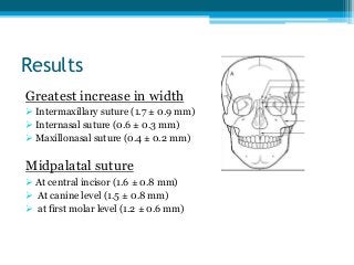 Results
Greatest increase in width
 Intermaxillary suture (1.7 ± 0.9 mm)
 Internasal suture (0.6 ± 0.3 mm)
 Maxillonasal suture (0.4 ± 0.2 mm)
Midpalatal suture
 At central incisor (1.6 ± 0.8 mm)
 At canine level (1.5 ± 0.8 mm)
 at first molar level (1.2 ± 0.6 mm)
 