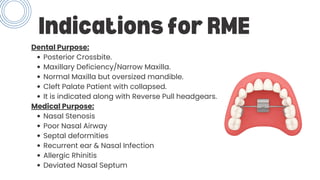 Rapid maxillary expansion and slow maxillary expansion | PDF