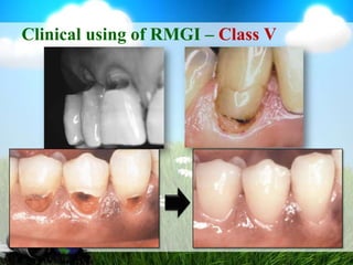 RMGI - RestorativeRinseDo notRinse