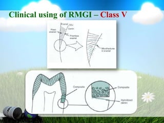 RMGI - Restorative10% Polyacrylic acid37% Phosphoric acid12,000x800xAn atlas of glass ionomer cements, 2002