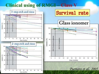 Clinical using of RMGI – Class V