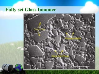 Fully set Glass Ionomer