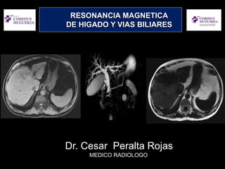 Dr. Cesar Peralta Rojas
MEDICO RADIOLOGO.
RESON.
RESONANCIA MAGNETICA
DE HIGADO Y VIAS BILIARES
 