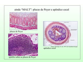 ainda “MALT”: placas de Peyer e apêndice cecal placas de Peyer epitélio sobre as placas de Peyer apêndice cecal Sobota, Histologia, 5a. ed., 1997, Ed. Guanabara Koogan.  