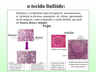 o tecido linfóide: linfócitos e  os diferentes tipos de fagócitos  mononucleares, aí  incluindo as diversas  populações  de  células  apresentado- ras de antígeno,  estão compondo o  tecido linfóide, que pode ser  frouxo, denso  e  nodular. Veja: frouxo denso mais células mono- nuleares fagocíticas, menos linfócitos bastante linfócitos, menos células mono- nucleares fagocíticas nodular nódulo em formação nódulo bem desenvolvido, evidenciando o manto e o centro germinativo o nodular tem celula- ridade do denso, or- ganizado, porém, em nódulos (= folículos) frouxo denso centro germinativo manto 