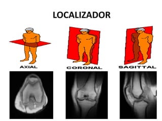LOCALIZADOR
 