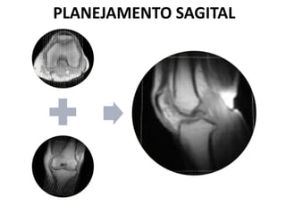 PLANEJAMENTO SAGITAL
 