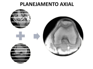 PLANEJAMENTO AXIAL
 