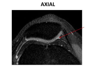 AXIAL
 