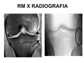 RM X RADIOGRAFIA
 