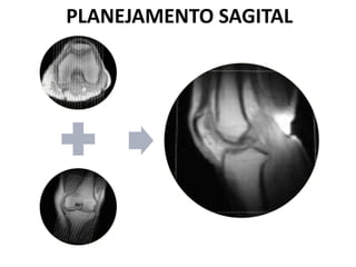 PLANEJAMENTO SAGITAL
 