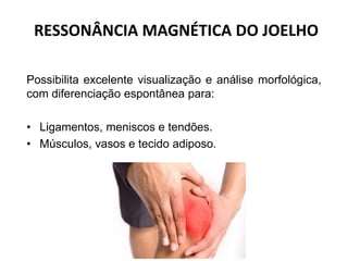RESSONÂNCIA MAGNÉTICA DO JOELHO
Possibilita excelente visualização e análise morfológica,
com diferenciação espontânea para:
• Ligamentos, meniscos e tendões.
• Músculos, vasos e tecido adiposo.
 
