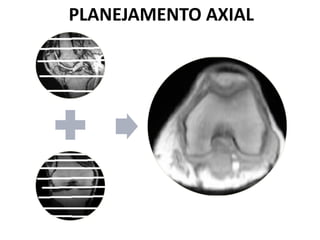 PLANEJAMENTO AXIAL
 