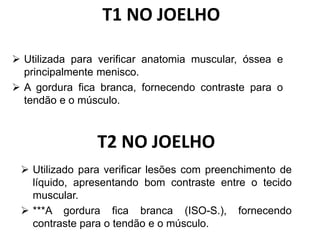 T1 NO JOELHO
 Utilizada para verificar anatomia muscular, óssea e
principalmente menisco.
 A gordura fica branca, fornecendo contraste para o
tendão e o músculo.
T2 NO JOELHO
 Utilizado para verificar lesões com preenchimento de
líquido, apresentando bom contraste entre o tecido
muscular.
 ***A gordura fica branca (ISO-S.), fornecendo
contraste para o tendão e o músculo.
 