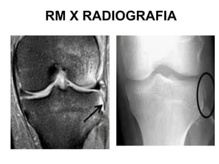 RM X RADIOGRAFIA
 