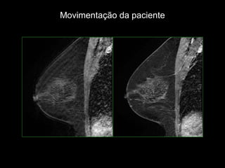 Movimentação da paciente  