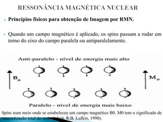  Princípios físicos para obtenção de Imagem por RMN.
 Quando um campo magnético é aplicado, os spins passam a rodar em
torno do eixo do campo paralela ou antiparalelamente.
Spins num meio onde se estabeleceu um campo magnético B0. M0 tem o significado de
magnetização total do meio (adapt. R.B. Lufkin, 1990).
 