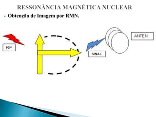  Obtenção de Imagem por RMN.
 
