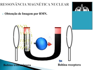  Obtenção de Imagem por RMN.
Bobina transmissora Bobina receptora
 