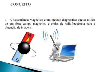  A Ressonância Magnética é um método diagnóstico que se utiliza
de um forte campo magnético e ondas de radiofrequência para a
obtenção de imagens.
 