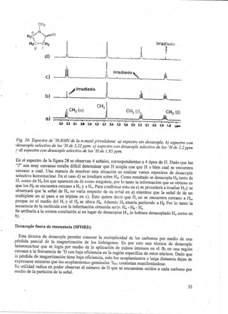 Guia de Seminario: RMN