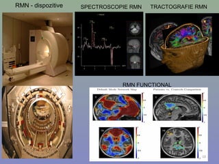 RMN - dispozitive SPECTROSCOPIE RMN TRACTOGRAFIE RMN
RMN FUNCTIONAL
10
 