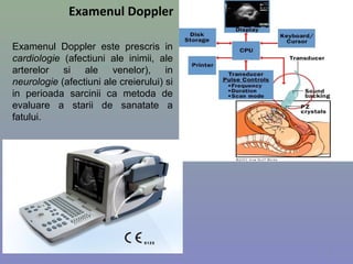 Examenul Doppler
Examenul Doppler este prescris in
cardiologie (afectiuni ale inimii, ale
arterelor si ale venelor), in
neurologie (afectiuni ale creierului) si
in perioada sarcinii ca metoda de
evaluare a starii de sanatate a
fatului.
3
 