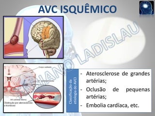 Classificação da
etiologia do AVCI

AVC ISQUÊMICO

- Aterosclerose de grandes
artérias;
- Oclusão de pequenas
artérias;
- Embolia cardíaca, etc.

 