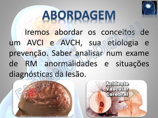 ABORDAGEM
Iremos abordar os conceitos de
um AVCI e AVCH, sua etiologia e
prevenção. Saber analisar num exame
de RM anormalidades e situações
diagnósticas da lesão.

 