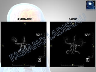 LESIONADO

SADIO

 
