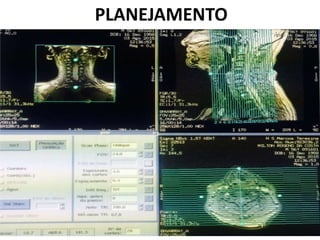 PLANEJAMENTO
 