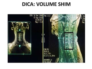 DICA: VOLUME SHIM
 
