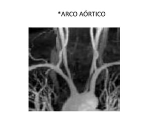 *ARCO AÓRTICO
 