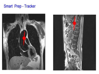 RM PESCOÇO E ANGIO-CARÓTIDAS