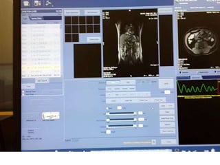 RM PESCOÇO E ANGIO-CARÓTIDAS