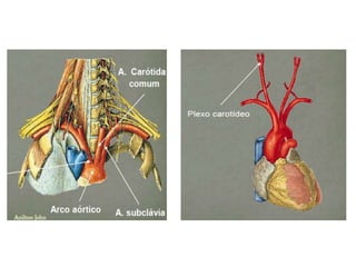 RM PESCOÇO E ANGIO-CARÓTIDAS