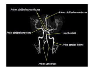 RM PESCOÇO E ANGIO-CARÓTIDAS