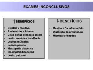 ↑BENEFÍCIOS
• Cicatriz x recidiva
• Assimetrias x lobular
• Cisto denso x nódulo sólido
• Lesão em única incidência
• Lesões múltiplas
• Lesões parede
• Mastopatia diabética
• Incompatibilidade BX
• Lesão palpável
 BENEFÍCIOS
• Mastite x Ca inflamatório
• Distorção da arquitetura
• Microcalcificações
EXAMES INCONCLUSIVOS
 